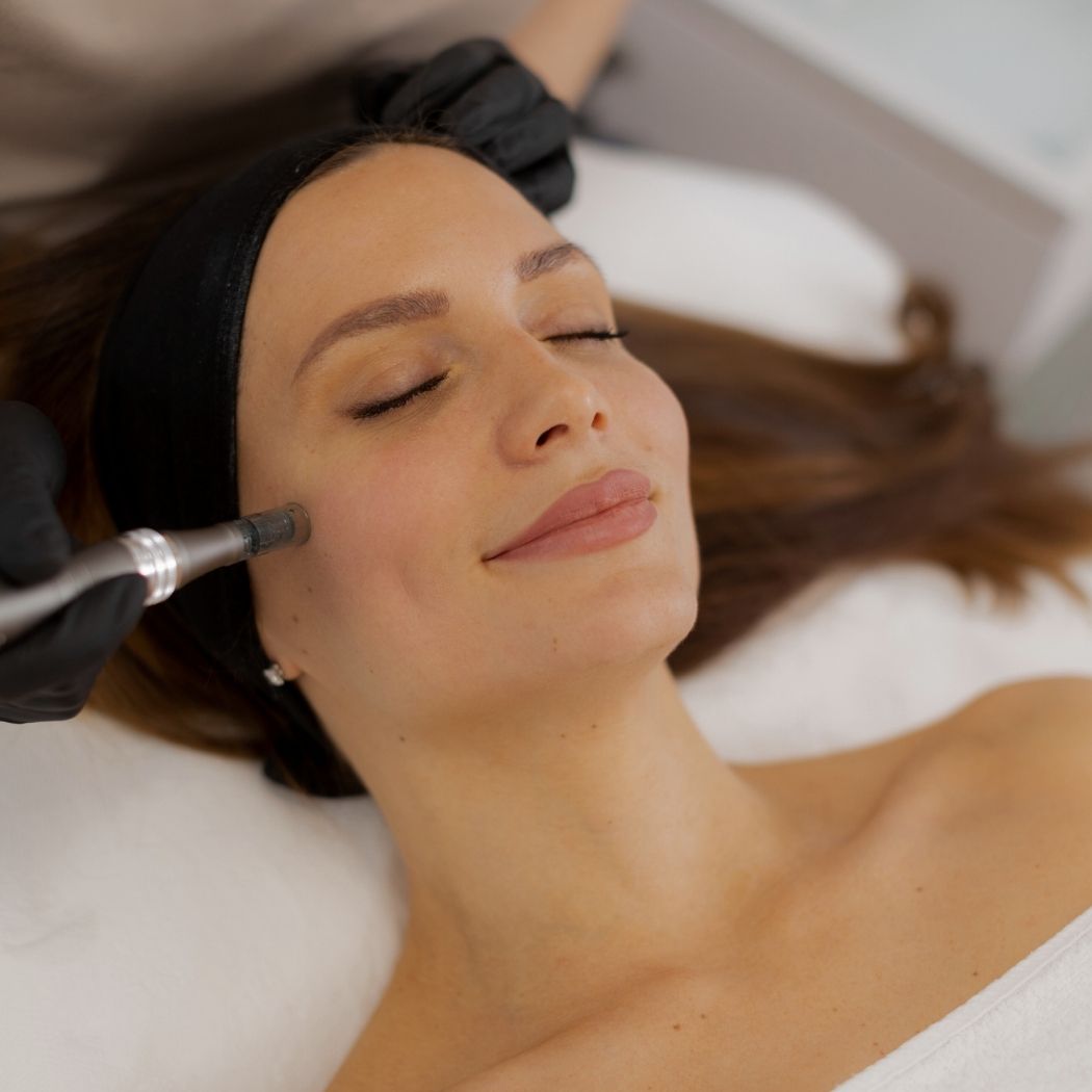 Microneedling Aurora Beauty Berlin